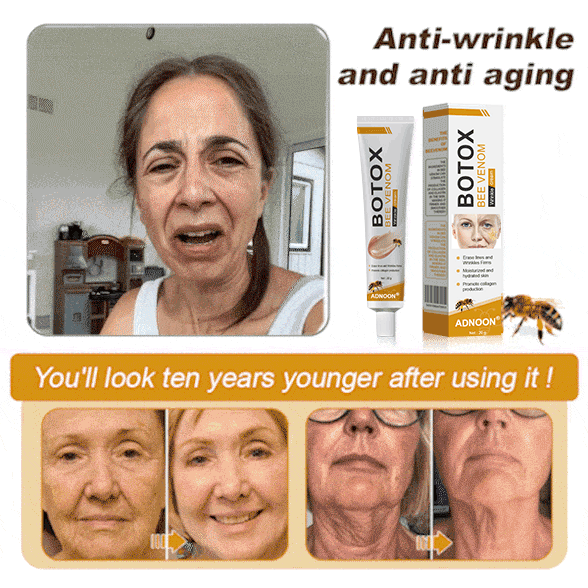(Made and Shipped from USA✅) ADNOON®Botox Bee Venom Wrinkle Removal Cream- LAST DAY 80% OFF
