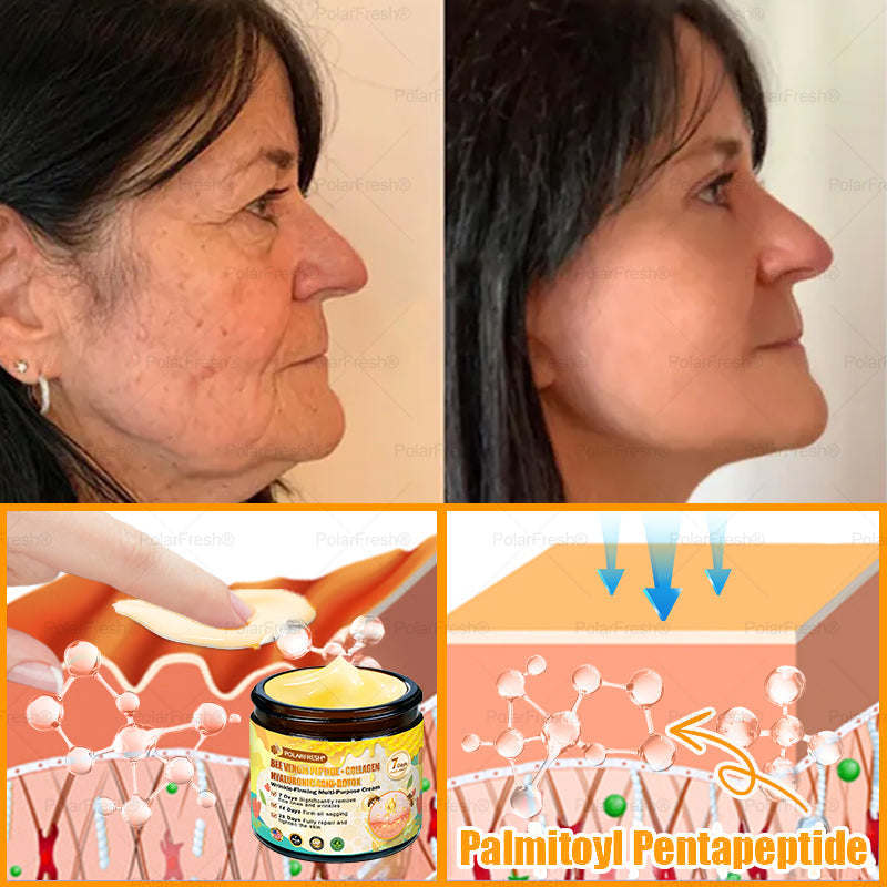 🗽Made & Shipped from USA | Clinically Proven: PolarFresh® Bee Venom Comprehensive Cream with bee venom peptides, botulinum toxin, hyaluronic acid, and collagen💧. Targets wrinkles, fine lines, sagging, stretch marks, dark spots and more