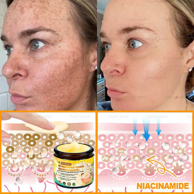 🗽Made & Shipped from USA | Clinically Proven: PolarFresh® Bee Venom Comprehensive Cream with bee venom peptides, botulinum toxin, hyaluronic acid, and collagen💧. Targets wrinkles, fine lines, sagging, stretch marks, dark spots and more