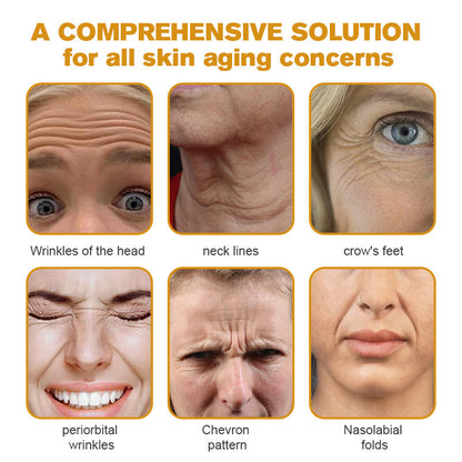 (Made and Shipped from USA✅) ADNOON®Botox Bee Venom Wrinkle Removal Cream- LAST DAY 80% OFF